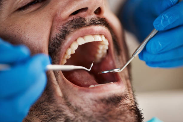 Full Mouth Reconstruction in Houston, MO